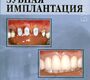 Зубная имплантация. Кулаков А.А. 2006 г.