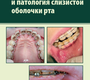 Ортодонтия и патология слизистой оболочки рта. Цветкова М.А. 2023г.
