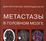 Метастазы в головном мозге. Диагностическая нейрорадиология.  Корниенко В.Н., Долгушин М.Б., Пронин И.Н. 2017г.