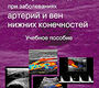 Ультразвуковое исследование при заболеваниях артерий и вен нижних конечностей.  Носенко Е.М., Носенко Н.С., Дадова Л.В. 2021г.