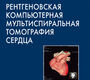 Рентгеновская компьютерная мультиспиральная томография сердца. Сергеев В.А. 2009г.