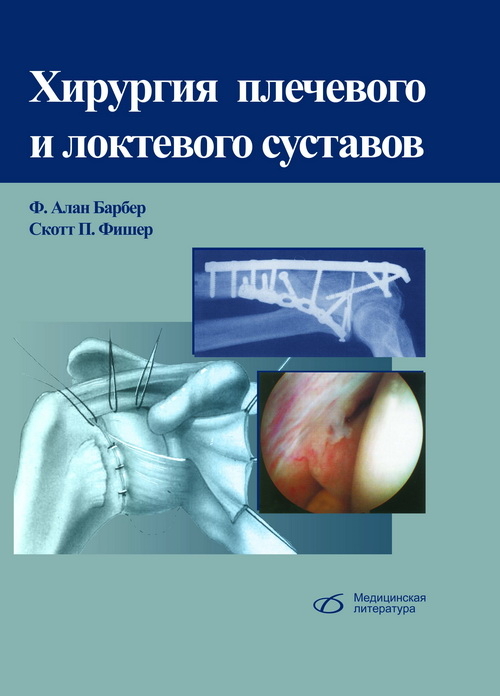 Хирургия плечевого и локтевого суставов. Барбер Ф.А. 2014 г.