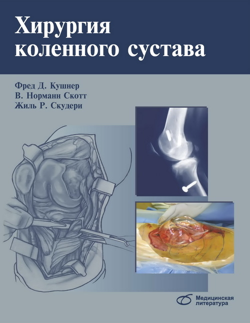 Хирургия коленного сустава. Кушнер Ф. Д., Скотт В. Н., Скудери Ж. Р. 2014 г.