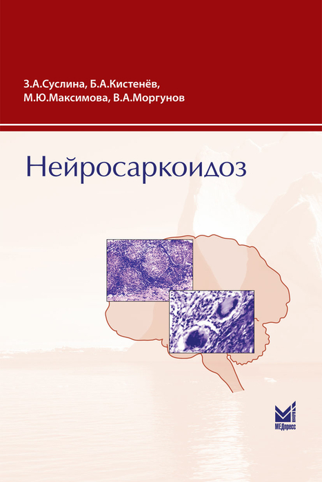 Нейросаркоидоз. Суслина З.А. 2009 г.