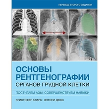 Основы рентгенографии органов грудной клетки. Кларк. 2024г.