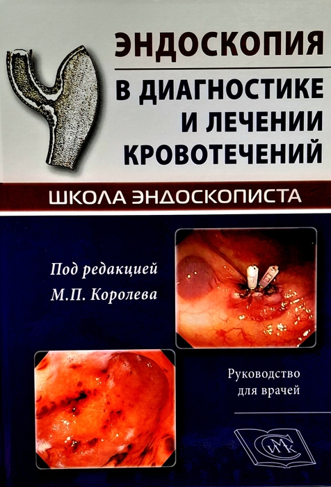 Эндоскопия в диагностике и лечении кровотечений. Королёв. 2025 г.