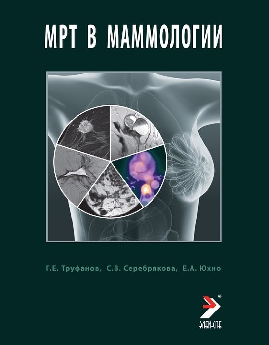 МРТ в маммологии: руководство для врачей. Труфанов. 2025 г.