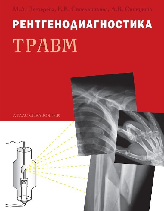 Рентгенодиагностика травм. Атлас-справочник Пестерева. 2026 г.