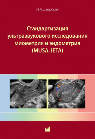 Стандартизация ультразвукового исследования миометрия и эндометрия (MUSA, IETA). Озерская. 2025г