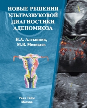 Новые решения ультразвуковой диагностики аденомиоза. Алтынник. 2024г.