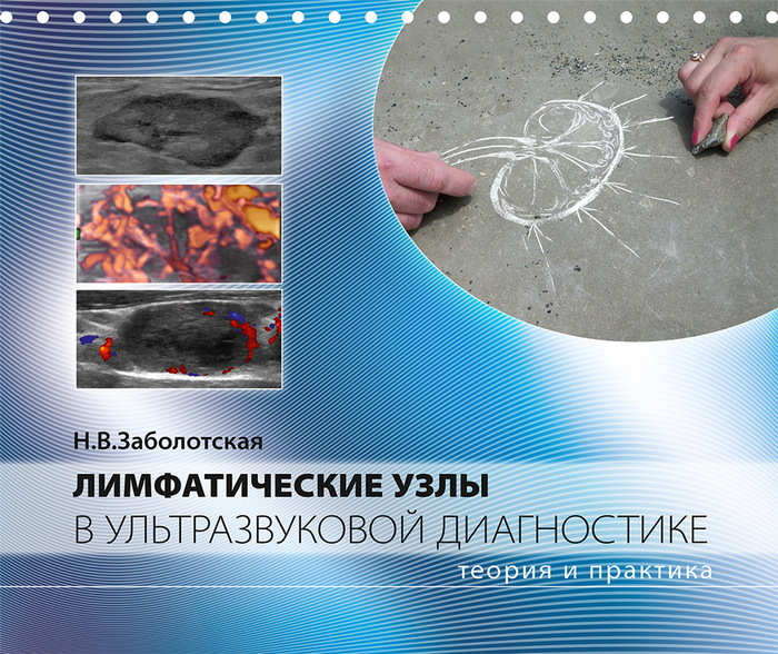 Лимфатические узлы в ультразвуковой диагностике. Заболотская. 2025 г.