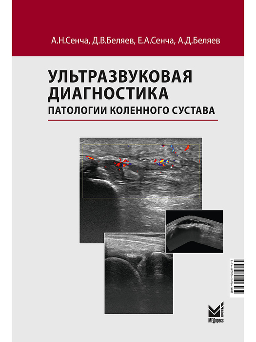 Ультразвуковая диагностика патологии коленного сустава. Сенча. 2026 г.