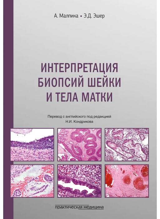 Интерпретация биопсий шейки и тела матки. Малпика. 2026 г.