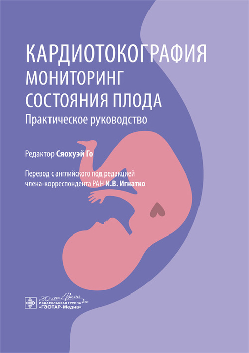 Кардиотокография. Мониторинг состояния плода. Сяохуэй. 2025 г.