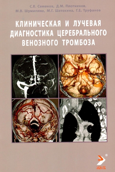 Клиническая и лучевая диагностика церебрального венозного тромбоза. Труфанов. 2026 г.