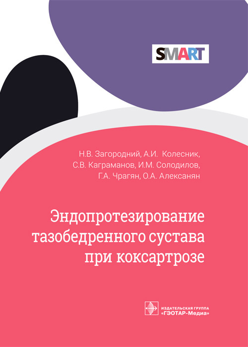 Эндопротезирование тазобедренного сустава при коксартрозе.  Загородний. 2022 г.