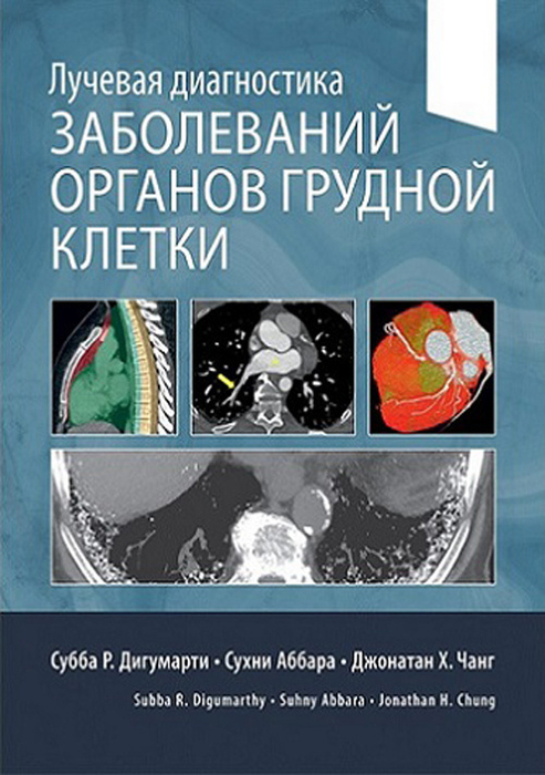 Лучевая диагностика заболеваний органов грудной клетки.  Дигумарти. 2023г.