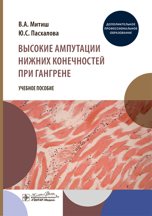 Высокие ампутации нижних конечностей при гангрене. Учебное пособие. Митиш. 2024г.