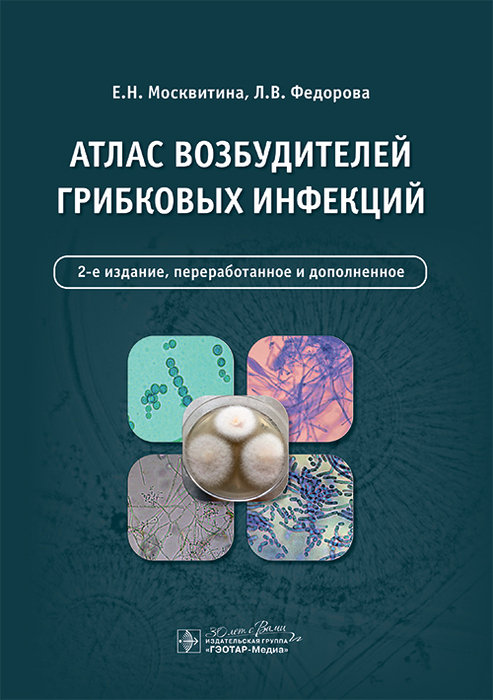 Атлас возбудителей грибковых инфекций. Москвитина. 2024г.