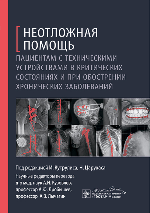 Неотложная помощь пациентам с техническими устройствами в критических состояниях и при обострении хронических заболеваний. Кутрулис. 2025г. 