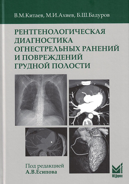 Рентгенологическая диагностика огнестрельных ранений и повреждений грудной полости. Китаев. 2025г.