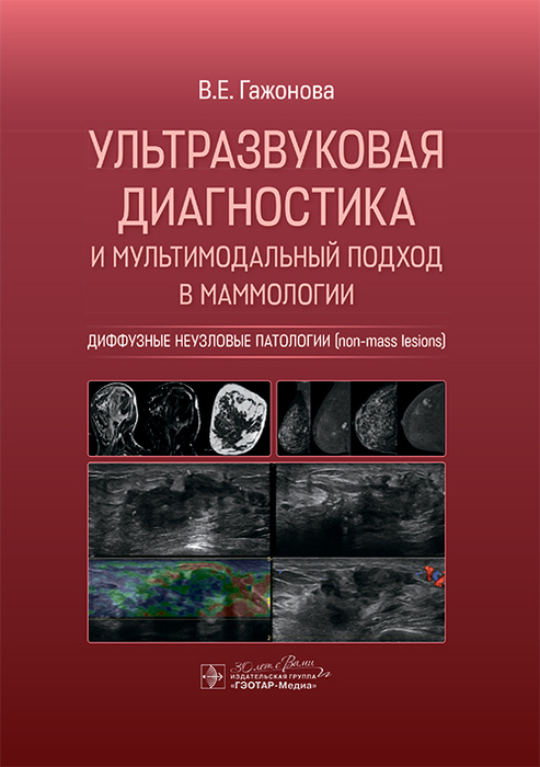 Ультразвуковая диагностика и мультимодальный подход в маммологии. Гажонова. 2025 г.