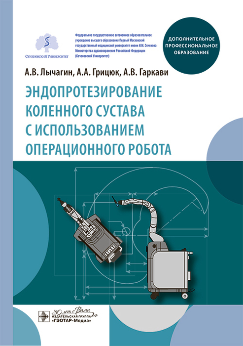 Эндопротезирование коленного сустава с использованием операционного робота. Лычагин. 2025 г.