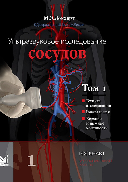 Ультразвуковое исследование сосудов. В 2-х томах. Том 1. Локхарт. 2025 г.