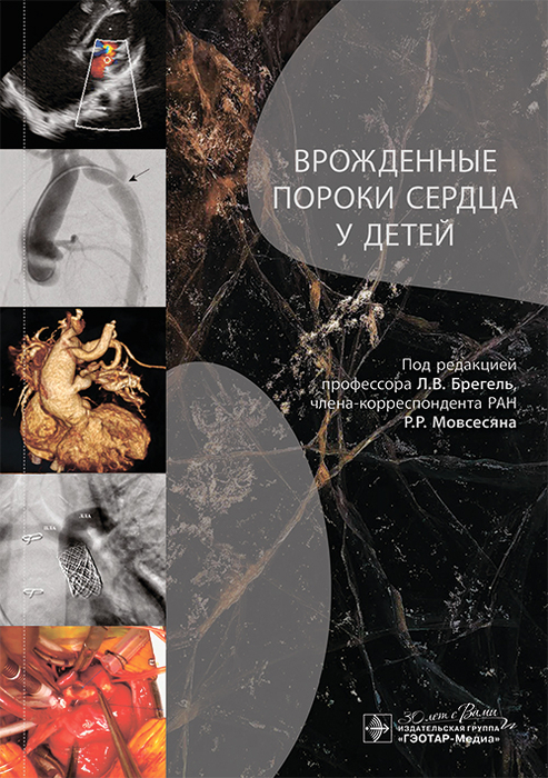 Врожденные пороки сердца у детей. Брегель. 2025 г.
