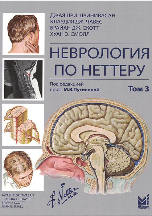 Неврология по Неттеру.  Том 3. 2026 г.