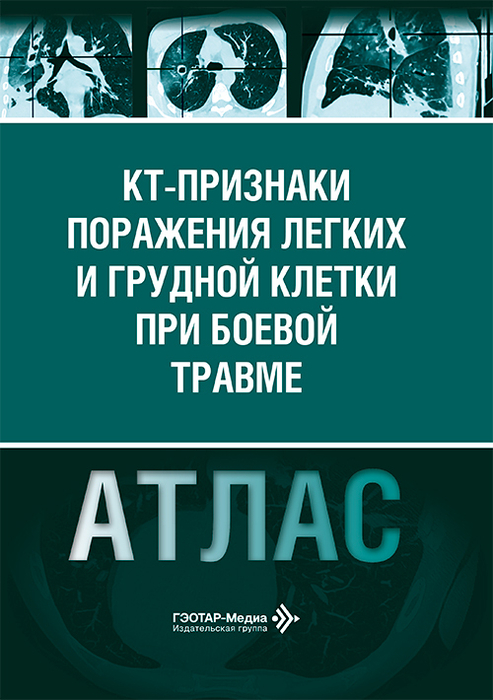 КТ-признаки поражения легких и грудной клетки при боевой травме. Атлас. Кошурников. 2026 г.