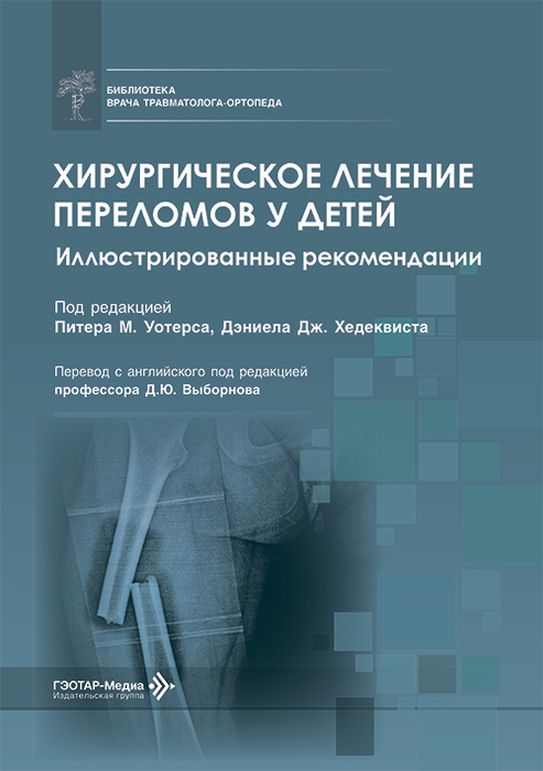 Хирургическое лечение переломов у детей. Уотерс. 2026 г.