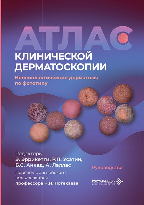 Атлас клинической дерматоскопии. Ненеопластические дерматозы по фототипу. Эррикетти.  2026 г.