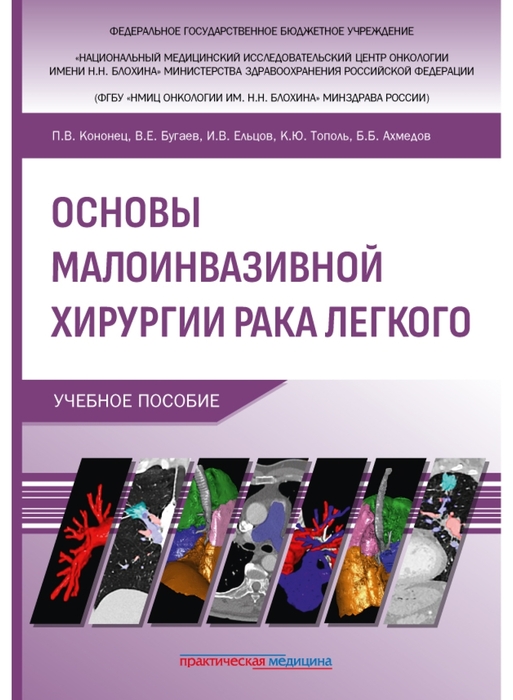 Основы малоинвазивной хирургии рака легкого. Кононец. 2025 г.