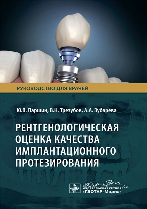 Рентгенологическая оценка качества имплантационного протезирования. Паршин. 2024г.