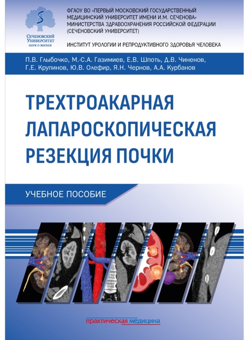 Трехтроакарная лапароскопическая резекция почки. Глыбочко.2025 г.