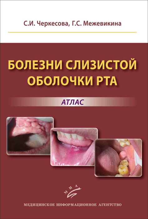 Болезни слизистой оболочки рта. Атлас. Черкесова. 2025 г.