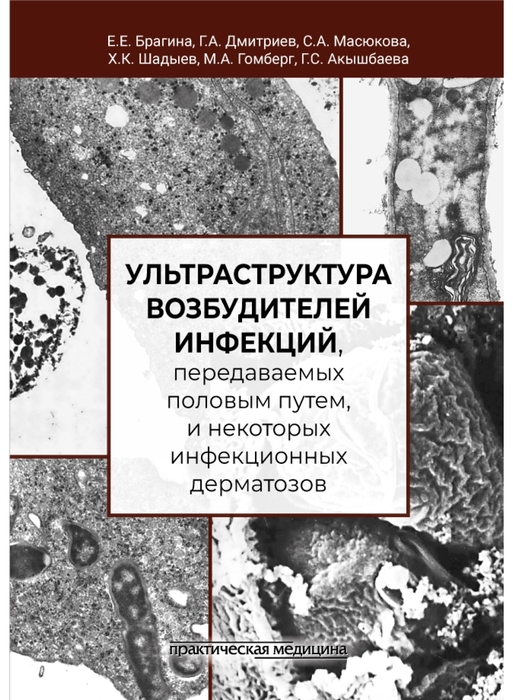 Ультраструктура возбудителей инфекций, передаваемых половым путем, и некоторых инфекционных дерматозов. Брагина. 2026 г.