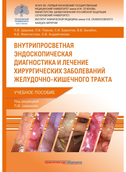 Внутрипросветная эндоскопическая диагностика и лечение хирургических заболеваний желудочно-кишечного тракта. Царьков. 2025 г.