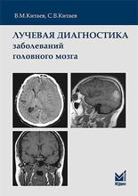 Лучевая диагностика заболеваний головного мозга. Китаев В.М., Китаев С.В.  3-е изд. 2022г.
