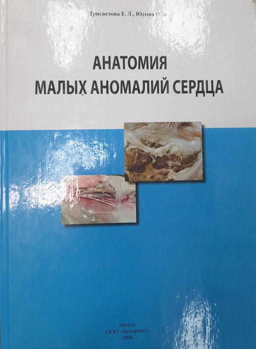 Анатомия малых аномалий сердца. Трисветова, Е. Л. Юдина, О. А. 2006г.