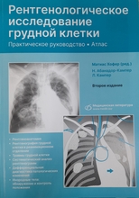 Рентгенологическое исследование грудной клетки. Хофер М. 2023 г.