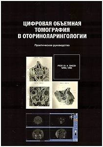 Цифровая объемная томография в оториноларингологии. Практическое руководство. 