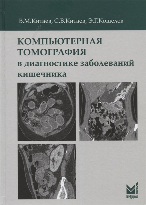 Компьютерная томография в диагностике заболеваний кишечника. В.М. Китаев, С.В. Китаев, Э.Г. Кошелев. 2020г.