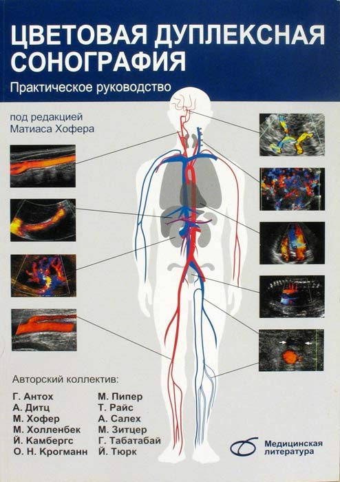 Цветовая дуплексная сонография. Хофер Матиас. 2007 г.