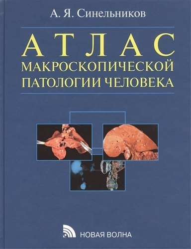 Атлас макроскопической патологии человека: учебное пособие.  Синельников А. 2007г.