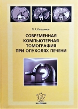 Современная компьютерная томография при опухолях печени. Калашников П.А. 2010г.