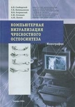 Компьютерная визуализация чрескостного остеосинтеза. Монография. Слободской. А.Б. 2004г.