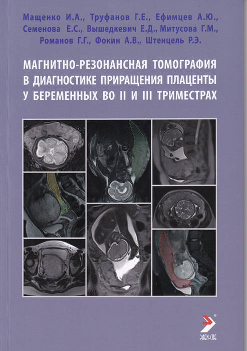 Магнитно-резонансная томография в диагностике приращения плаценты у беременных во II и III триместрах. Мащенко И.А., Труфанов Г.Е. 2021г.