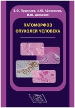Патоморфоз опухолей человека. Е.Ф. Лушников, А.Ю. Абросимов, Н.Ю. Двинских. 2021г.